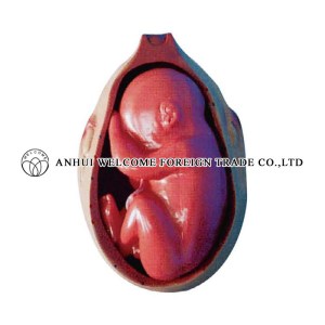 AH985 uterus w/em Bryo (10 Months)