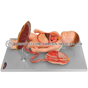 AH987 Baby with Placenta