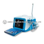 cx6000-digital-ultrasound-scanner